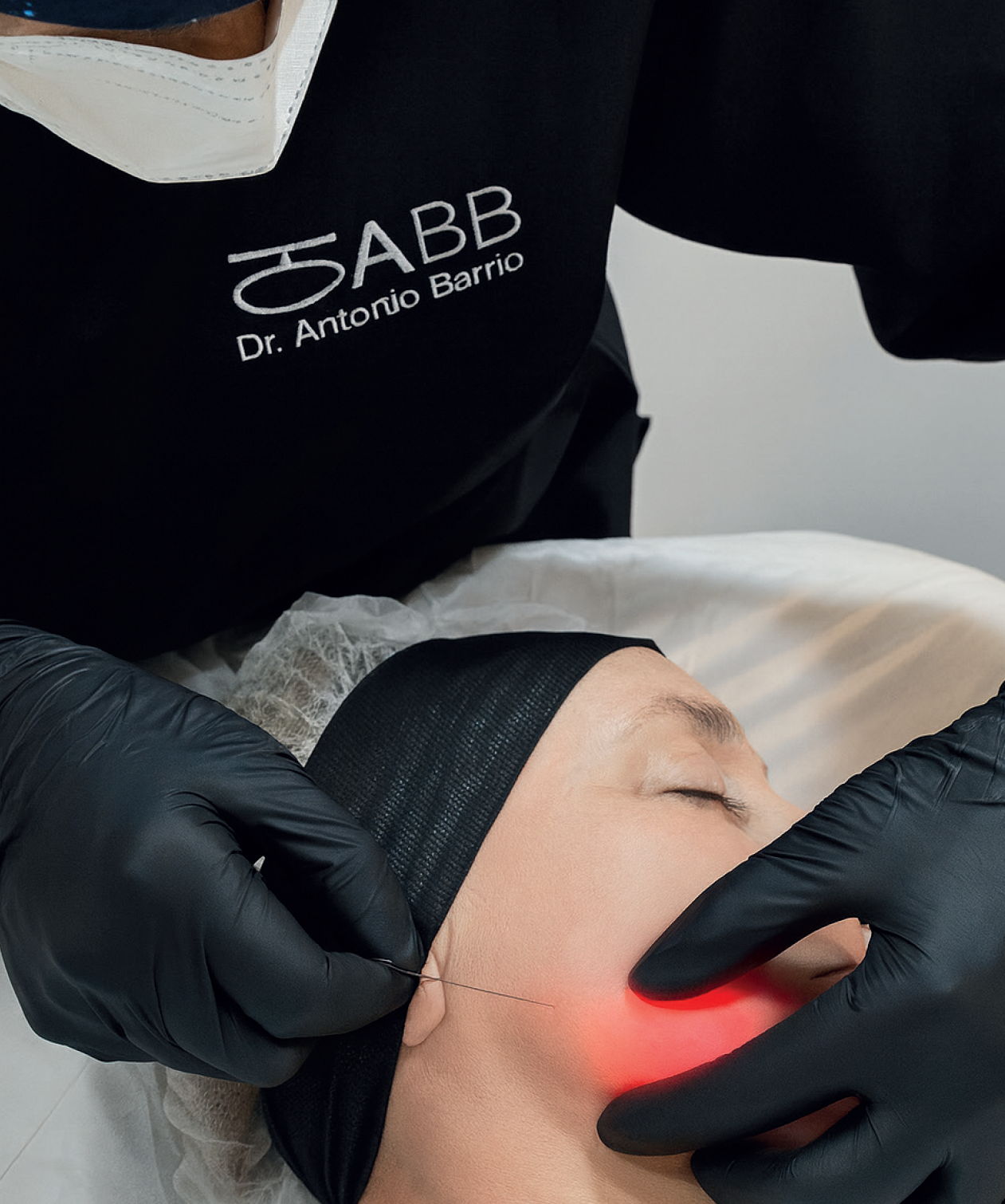 Eliminar papada con Endolift y Morpheus 8